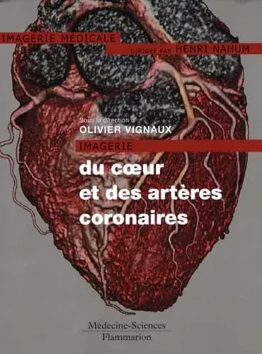 Couverture : Imagerie du coeur et des artères coronaires