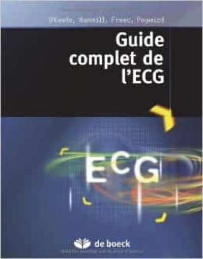 Guide complet de l’ECG